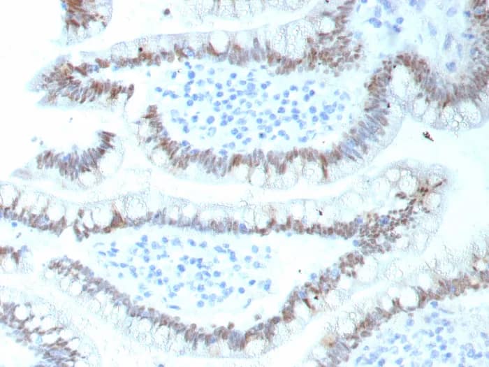 Immunohistochemistry-Paraffin: CDX2 Antibody (CDX2/9298R) - Azide and BSA Free [NBP3-24117] - Formalin-fixed, paraffin-embedded human colon stained with CDX2 Antibody (CDX2/9298R). HIER: Tris/EDTA, pH9.0, 45min. 2°C: HRP-polymer, 30min. DAB, 5min.