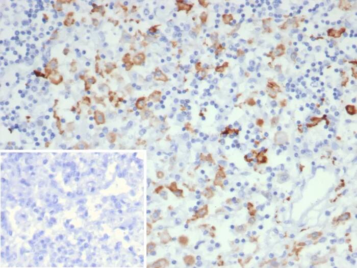 Immunohistochemistry-Paraffin: CD163L1 Antibody (CD163L1/7971) - Azide and BSA Free [NBP3-24128] - Formalin-fixed, paraffin-embedded human lymph node stained with CD163L1 Antibody (CD163L1/7971). Inset: PBS instead of primary antibody; secondary only negative control.