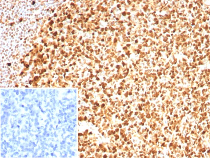 Formalin-fixed, paraffin-embedded human tonsil stained with PCNA antibody (PCNA/8633R) - Azide and BSA Free. Inset: PBS instead of primary antibody; secondary only negative control.