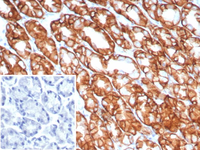 Formalin-fixed, paraffin-embedded human stomach stained with Claudin-18.2 antibody (CLDN18.2/8141R) - Azide and BSA Free. Inset: PBS instead of primary antibody; secondary only negative control.