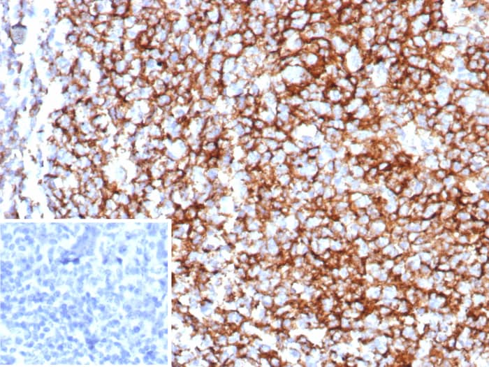 Formalin-fixed, paraffin-embedded human tonsil stained with CD35 antibody (rCR1/8597) - Azide and BSA Free. Inset: PBS instead of primary antibody; secondary only negative control.