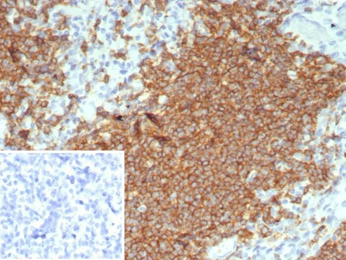 Immunohistochemistry-Paraffin: CD20 Antibody (rMS4A1/8044) - Azide and BSA Free [NBP3-24142] - Formalin-fixed, paraffin-embedded human tonsil stained with CD20 Antibody (rMS4A1/8044). Inset: PBS instead of primary antibody; secondary only negative control.