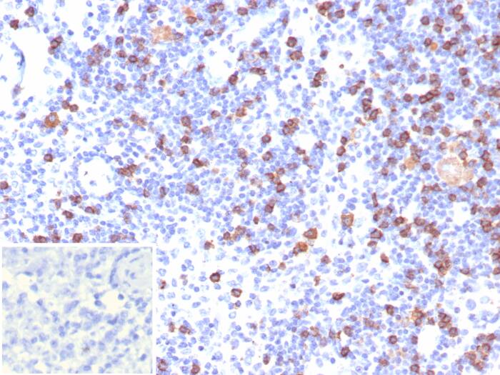 Formalin-fixed, paraffin-embedded human lymph node stained with CD8 antibody (CD8/7793R) - Azide and BSA Free. Inset: PBS instead of primary antibody; secondary only negative control.
