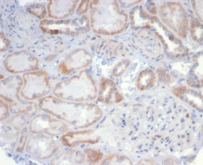 Immunohistochemistry-Paraffin: CD20 Antibody (MS4A1/6993R) - Azide and BSA Free [NBP3-24154] - Formalin-fixed, paraffin-embedded human kidney stained with CD20 Antibody (MS4A1/6993R). HIER: Tris/EDTA, pH9.0, 45min. 2°C: HRP-polymer, 30min. DAB, 5min.