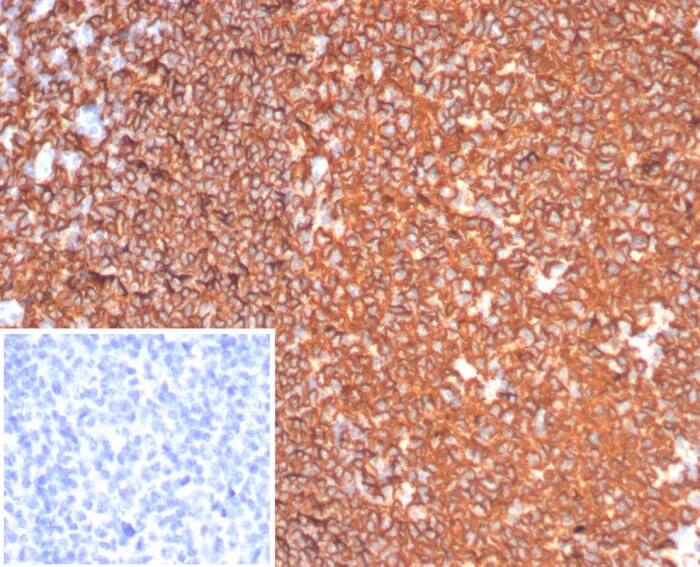 Immunohistochemistry-Paraffin: CD20 Antibody (MS4A1/6993R) - Azide and BSA Free [NBP3-24154] - Formalin-fixed, paraffin-embedded human tonsil stained with CD20 Antibody (MS4A1/6993R). HIER: Tris/EDTA, pH9.0, 45min. 2°C: HRP-polymer, 30min. DAB, 5min.
