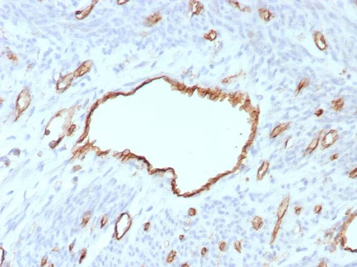 Immunohistochemistry-Paraffin: CD31/PECAM-1 Antibody (C31/8593R) - Azide and BSA Free [NBP3-24155] - Formalin-fixed, paraffin-embedded human uterus stained with CD31/PECAM-1 Antibody (C31/8593R). HIER: Tris/EDTA, pH9.0, 45min. 2°C: HRP-polymer, 30min. DAB, 5min.