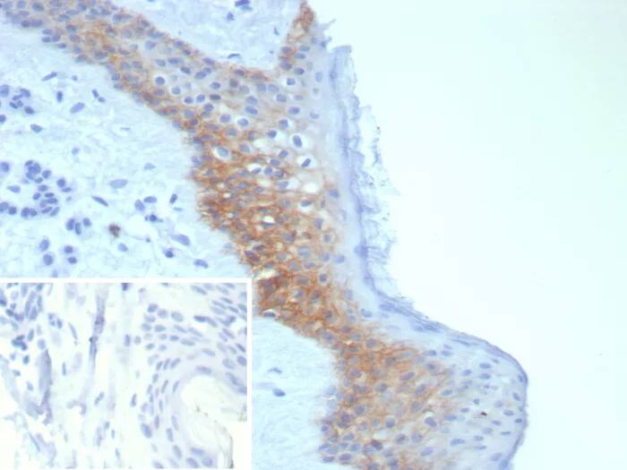 Immunohistochemistry-Paraffin: Desmoglein-3 Antibody (DSG3/8252R) - Azide and BSA Free [NBP3-24162] - Formalin-fixed, paraffin-embedded human skin stained with Desmoglein-3 Antibody (DSG3/8252R). Inset: PBS instead of primary antibody; secondary only negative control.