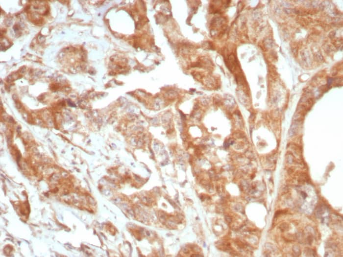 Formalin-fixed, paraffin-embedded human prostate stained with Podoplanin antibody (PDPN/8875R) - Azide and BSA Free. HIER: Tris/EDTA, pH9.0, 45min. Secondary: HRP-polymer, 30min. DAB, 5min.