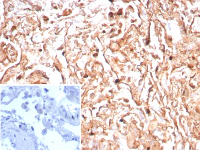 Formalin-fixed, paraffin-embedded human tonsil stained with Podoplanin antibody (PDPN/8950R) - Azide and BSA Free. Inset: PBS instead of primary antibody; secondary only negative control.
