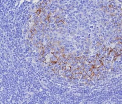 Immunohistochemistry-Paraffin: CD23/Fc epsilon RII Antibody (FCER2/8237R) - Azide and BSA Free [NBP3-24171] - Formalin-fixed, paraffin-embedded human tonsil stained with CD23/Fc epsilon RII Antibody (FCER2/8237R). HIER: Tris/EDTA, pH9.0, 45min. 2°C: HRP-polymer, 30min. DAB, 5min.