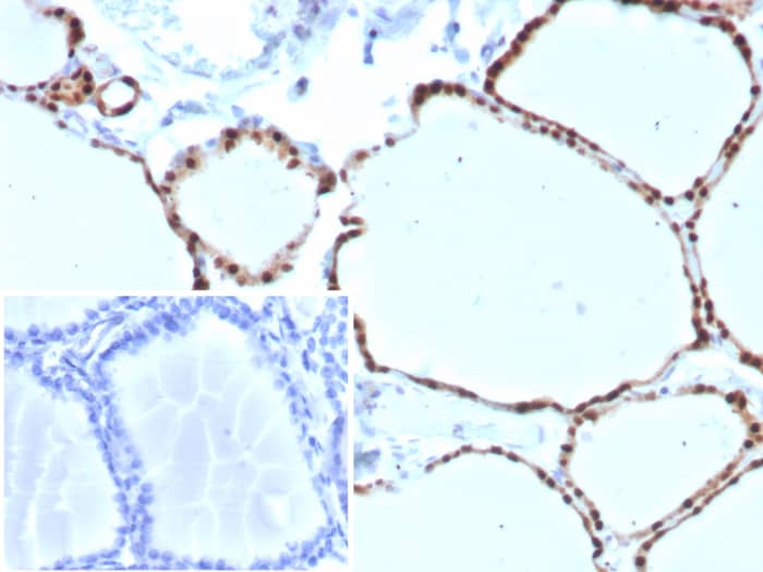 Formalin-fixed, paraffin-embedded human thyroid stained with PAX8 antibody (PAX8/8973R) - Azide and BSA Free. HIER: Tris/EDTA, pH9.0, 45min. Secondary: HRP-polymer, 30min. DAB, 5min.