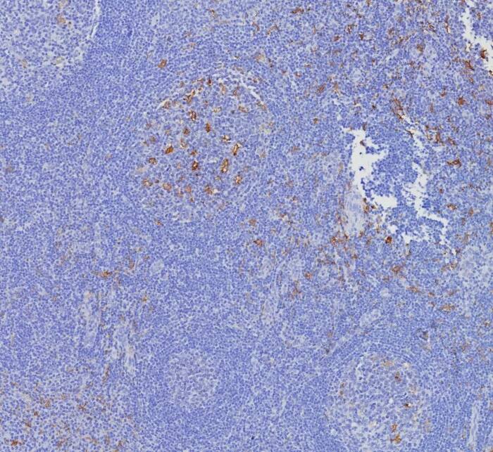 Immunohistochemistry-Paraffin: CD163L1 Antibody (CD163L1/7972) - Azide and BSA Free [NBP3-24185] - Formalin-fixed, paraffin-embedded human tonsil stained with CD163L1 Antibody (CD163L1/7972). HIER: Tris/EDTA, pH9.0, 45min. 2°C: HRP-polymer, 30min. DAB, 5min.