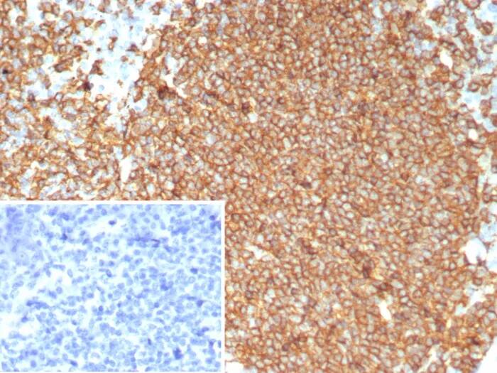 Immunohistochemistry-Paraffin: CD20 Antibody (MS4A1/8072R) - Azide and BSA Free [NBP3-24187] - Formalin-fixed, paraffin-embedded human tonsil stained with CD20 Antibody (MS4A1/8072R). Inset: PBS instead of primary antibody; secondary only negative control.