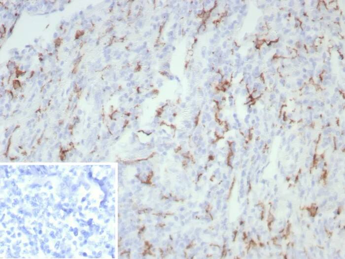 Immunohistochemistry-Paraffin: CD163 Antibody (rM130/8823) - Azide and BSA Free [NBP3-24189] - Formalin-fixed, paraffin-embedded human tonsil stained with CD163 Antibody (rM130/8823). Inset: PBS instead of primary antibody; secondary only negative control.