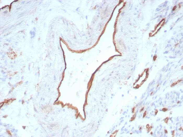 Immunohistochemistry-Paraffin: CD31/PECAM-1 Antibody (C31/8831R) - Azide and BSA Free [NBP3-24194] - Formalin-fixed, paraffin-embedded human uterus stained with CD31/PECAM-1 Antibody (C31/8831R). HIER: Tris/EDTA, pH9.0, 45min. 2°C: HRP-polymer, 30min. DAB, 5min.
