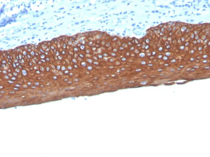 Immunohistochemistry-Paraffin: Cytokeratin, pan Antibody (MonoPoly/4999R) - Azide and BSA Free [NBP3-24196] - Formalin-fixed, paraffin-embedded human tonsil stained with Cytokeratin, pan Antibody (MonoPoly/4999R)