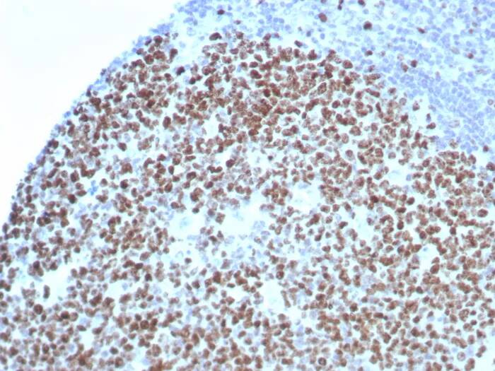 Immunohistochemistry-Paraffin: Ki67/MKI67 Antibody (rMKI67/8852) - Azide and BSA Free [NBP3-24199] - Formalin-fixed, paraffin-embedded human tonsil stained with Ki67/MKI67 Antibody (rMKI67/8852). HIER: Tris/EDTA, pH9.0, 45min. 2°C: HRP-polymer, 30min. DAB, 5min.