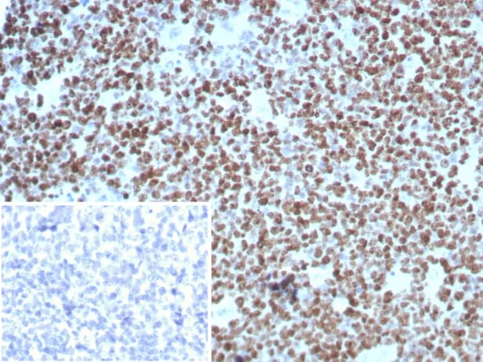 Immunohistochemistry-Paraffin: Ki67/MKI67 Antibody (rMKI67/8852) - Azide and BSA Free [NBP3-24199] - Formalin-fixed, paraffin-embedded human tonsil stained with Ki67/MKI67 Antibody (rMKI67/8852). Inset: PBS instead of primary antibody; secondary only negative control.