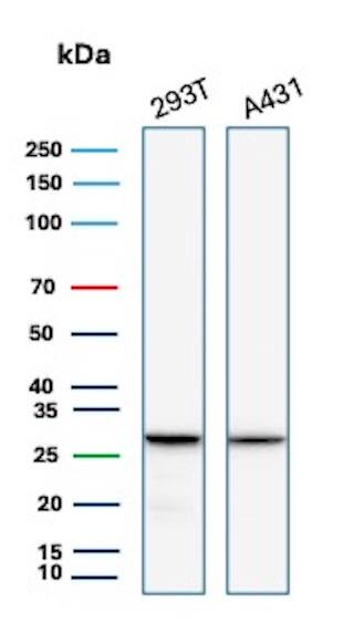 Western blot analysis of 293T and A431 lysates using RPS23 Antibody (rYWHAE/8860) - Azide and BSA Free. 