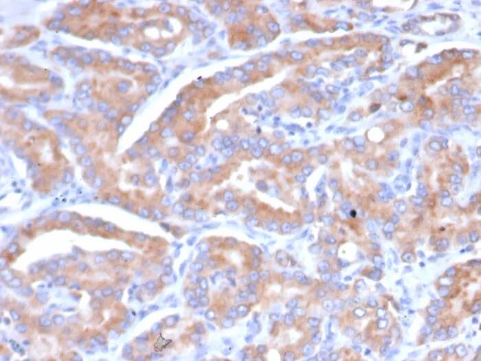 Immunohistochemistry-Paraffin: CHID1 Antibody (CHID1/6368) - Azide and BSA Free [NBP3-24214] - Formalin-fixed, paraffin-embedded human prostate stained with CHID1 Antibody (CHID1/6368) HIER: Tris/EDTA, pH9.0, 45min. 2°C: HRP-polymer, 30min. DAB, 5min.