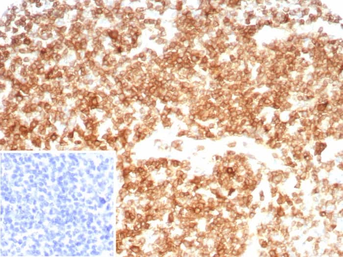 Immunohistochemistry-Paraffin: CD27/TNFRSF7 Antibody (LPFS2/8607R) - Azide and BSA Free [NBP3-24224] - Formalin-fixed, paraffin-embedded human tonsil stained with CD27/TNFRSF7 Antibody (LPFS2/8607R). Inset: PBS instead of primary antibody; secondary only negative control.