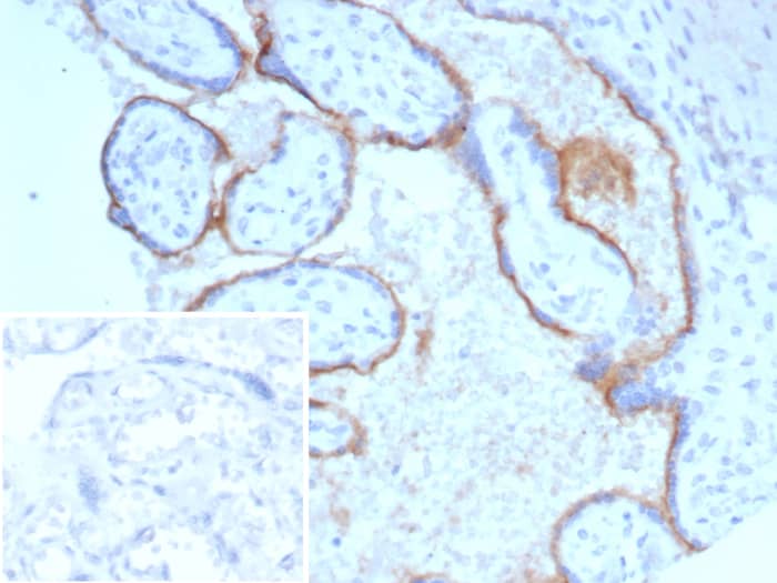 Formalin-fixed, paraffin-embedded human placenta stained with Endoglin/CD105 antibody (ENG/8069R) - Azide and BSA Free Inset: PBS instead of primary antibody; secondary only negative control.