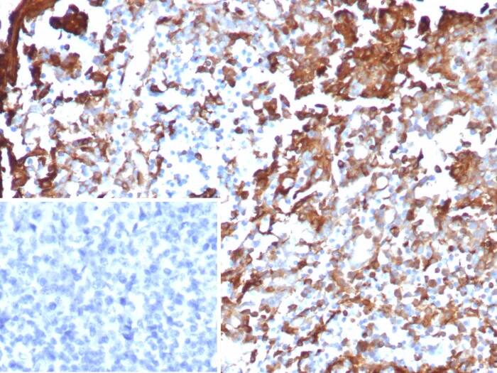 Immunohistochemistry-Paraffin: Annexin A1 Antibody (rANXA1/6451) - Azide and BSA Free [NBP3-24228] - Formalin-fixed, paraffin-embedded human tonsil stained with Annexin A1 Antibody (rANXA1/6451). Inset: PBS instead of primary antibody; secondary only negative control.