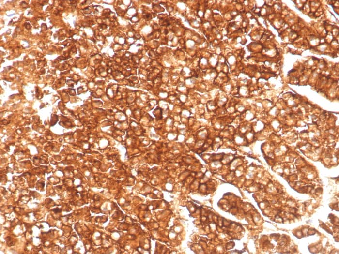 Formalin-fixed, paraffin-embedded human adrenal gland stained with MDR1/ABCB1 antibody (MDR1/8986R) - Azide and BSA Free. HIER: Tris/EDTA, pH9.0, 45min. Secondary: HRP-polymer, 30min. DAB, 5min.