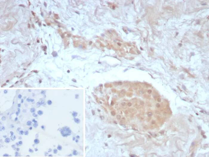 Immunohistochemistry-Paraffin: Survivin Antibody (BIRC5/8987R) - Azide and BSA Free [NBP3-24237] - Formalin-fixed, paraffin-embedded human testis stained with Survivin Antibody (BIRC5/8987R). Inset: PBS instead of primary antibody; secondary only negative control.