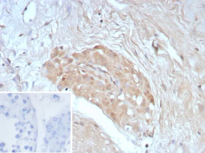 Immunohistochemistry-Paraffin: Survivin Antibody (BIRC5/8936R) - Azide and BSA Free [NBP3-24238] - Formalin-fixed, paraffin-embedded human testis stained with Survivin Antibody (BIRC5/8936R). Inset: PBS instead of primary antibody; secondary only negative control.