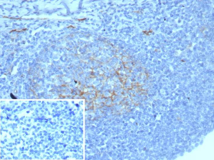 Immunohistochemistry-Paraffin: ICAM-1/CD54 Antibody (ICAM1/8677R) - Azide and BSA Free [NBP3-24243] - Formalin-fixed, paraffin-embedded human tonsil stained with ICAM-1/CD54 Antibody (ICAM1/8677R). Inset: PBS instead of primary antibody; secondary only negative control.