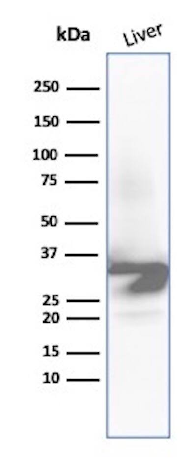 Western Blot Analysis of Human Liver tissue lysate using ICAM-1/CD54 Antibody (ICAM1/9379R) - Azide and BSA Free.
