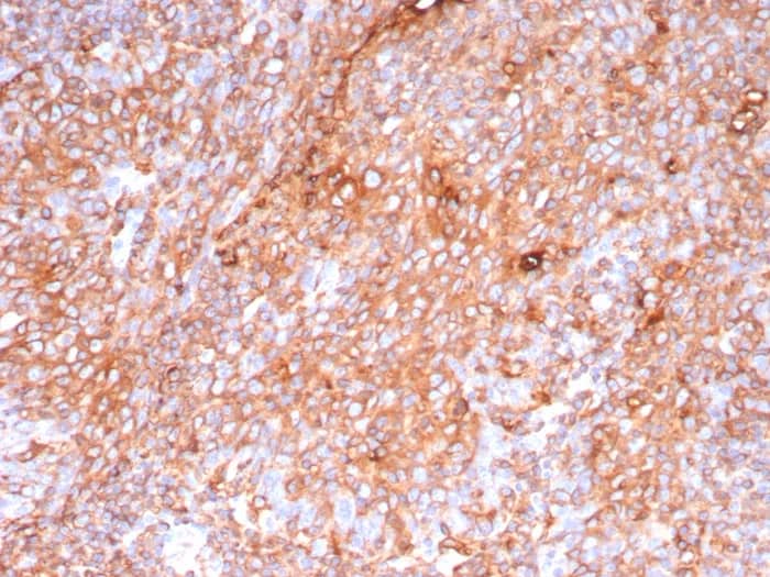 Immunohistochemistry-Paraffin: HLA DQ/DR/DP Antibody (HLA-Pan/9268R) - Azide and BSA Free [NBP3-24248] - Formalin-fixed, paraffin-embedded human tonsil stained with HLA DQ/DR/DP Antibody (HLA-Pan/9268R). HIER: Tris/EDTA, pH9.0, 45min. 2°C: HRP-polymer, 30min. DAB, 5min.