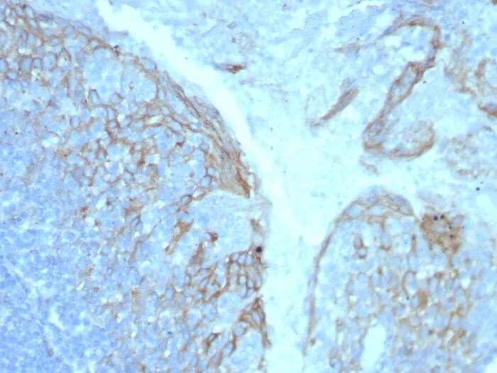 Immunohistochemistry-Paraffin: ICAM-1/CD54 Antibody (ICAM1/8247R) - Azide and BSA Free [NBP3-24249] - Formalin-fixed, paraffin-embedded human tonsil stained with ICAM-1/CD54 Antibody (ICAM1/8247R). HIER: Tris/EDTA, pH9.0, 45min. 2°C: HRP-polymer, 30min. DAB, 5min.