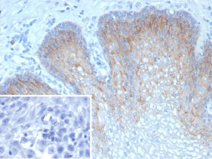 Immunohistochemistry-Paraffin: TRIM29 Antibody (TRIM29/9256R) - Azide and BSA Free [NBP3-24254] - Formalin-fixed, paraffin-embedded human esophagus stained with TRIM29 Antibody (TRIM29/9256R). Inset: PBS instead of primary antibody; secondary only negative control.