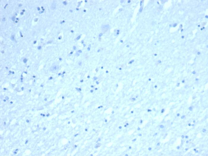 IHC analysis of formalin-fixed, paraffin-embedded human brain. Negative tissue control using Inhibin alpha antibody (INHA/8872R) - Azide and BSA Free at 2ug/ml in PBS for 30min RT. HIER: Tris/EDTA, pH9.0, 45min. Secondary: HRP-polymer, 30min. DAB, 5min.