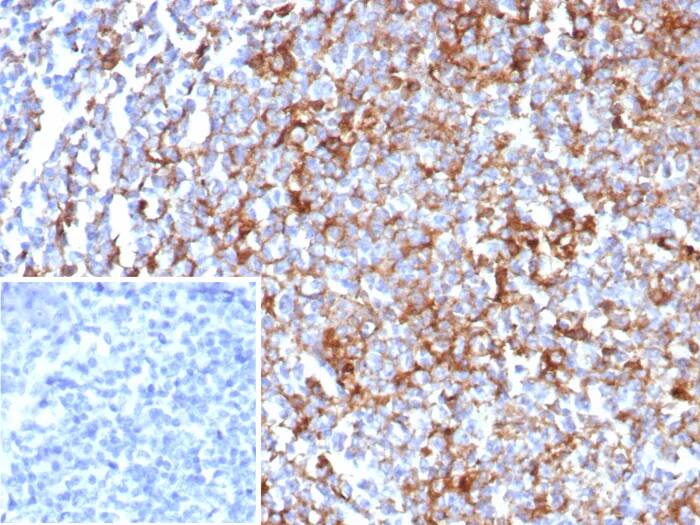 Immunohistochemistry-Paraffin: CD63 Antibody (rLAMP3/8604) - Azide and BSA Free [NBP3-24267] - Formalin-fixed, paraffin-embedded human tonsil stained with CD63 Antibody (rLAMP3/8604). Inset: PBS instead of primary antibody; secondary only negative control.
