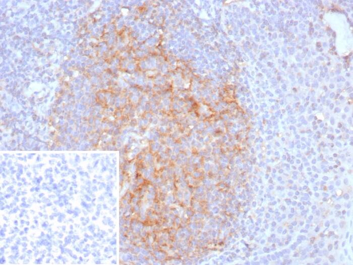 Formalin-fixed, paraffin-embedded human tonsil stained with CD35 antibody (CR1/8282R) - Azide and BSA Free. Inset: PBS instead of primary antibody; secondary only negative control.