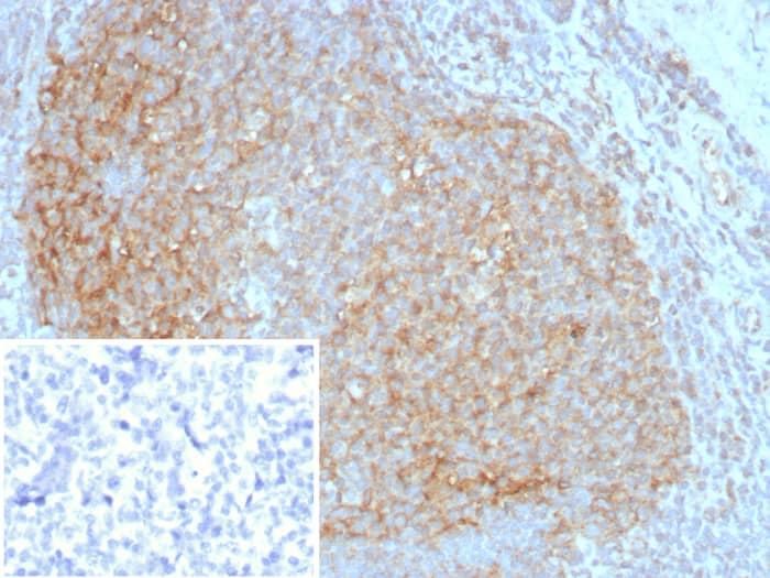 Formalin-fixed, paraffin-embedded human tonsil stained with CD35 antibody (CR1/8283R) - Azide and BSA Free. Inset: PBS instead of primary antibody; secondary only negative control.