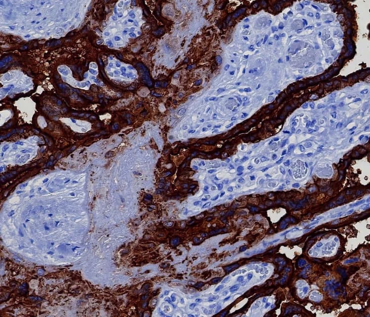 Immunohistochemistry-Paraffin: Alkaline Phosphatase/ALPP Antibody (ALPP/8112R) - Azide and BSA Free [NBP3-24271] - Formalin-fixed, paraffin-embedded human placenta stained with Alkaline Phosphatase/ALPP Antibody (ALPP/8112R). HIER: Tris/EDTA, pH9.0, 45min. 2°C: HRP-polymer, 30min. DAB, 5min.