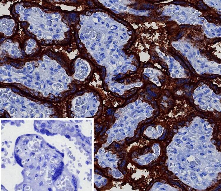 Immunohistochemistry-Paraffin: Alkaline Phosphatase/ALPP Antibody (ALPP/8112R) - Azide and BSA Free [NBP3-24271] - Formalin-fixed, paraffin-embedded human placenta stained with Alkaline Phosphatase/ALPP Antibody (ALPP/8112R). Inset: PBS instead of primary antibody; secondary only negative control.