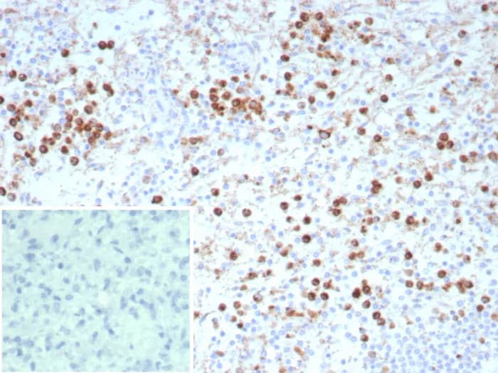Immunohistochemistry-Paraffin: CD63 Antibody (rLAMP3/9131) - Azide and BSA Free [NBP3-24272] - Formalin-fixed, paraffin-embedded human spleen stained with CD63 Antibody (rLAMP3/9131). Inset: PBS instead of primary antibody; secondary only negative control.