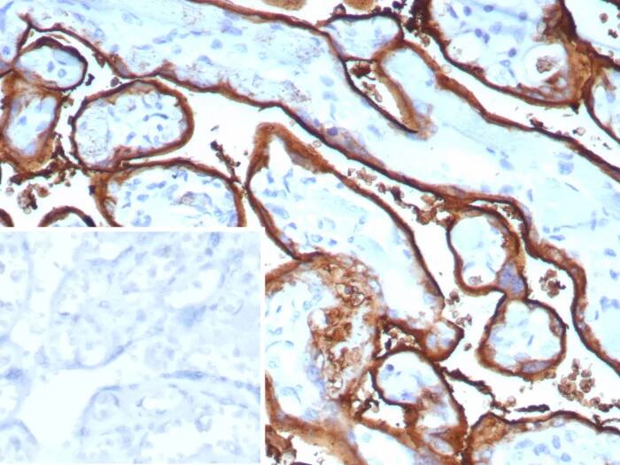 Immunohistochemistry-Paraffin: Alkaline Phosphatase/ALPP Antibody (ALPP/9109R) - Azide and BSA Free [NBP3-24277] - Formalin-fixed, paraffin-embedded human tonsil stained with Alkaline Phosphatase/ALPP Antibody (ALPP/9109R). Inset: PBS instead of primary antibody; secondary only negative control.
