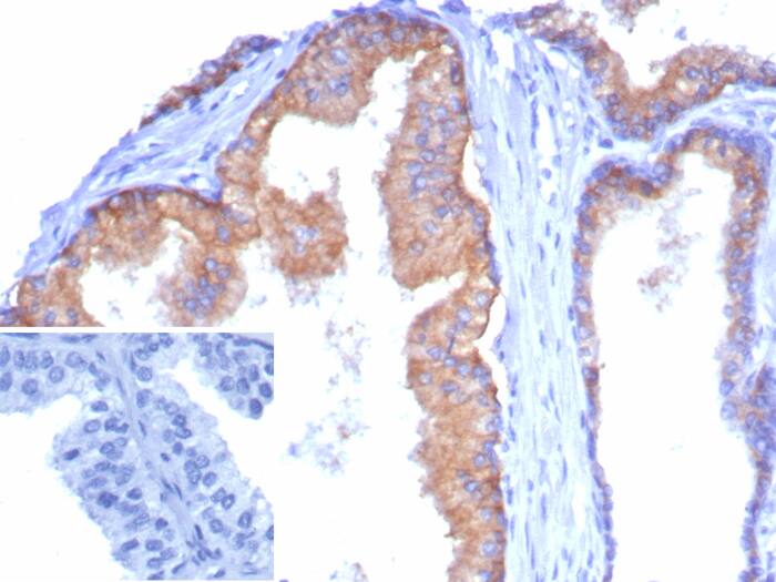 Formalin-fixed, paraffin-embedded human tonsil stained with CD38 antibody (CD38/8335R) - Azide and BSA Free. Inset: PBS instead of primary antibody; secondary only negative control.