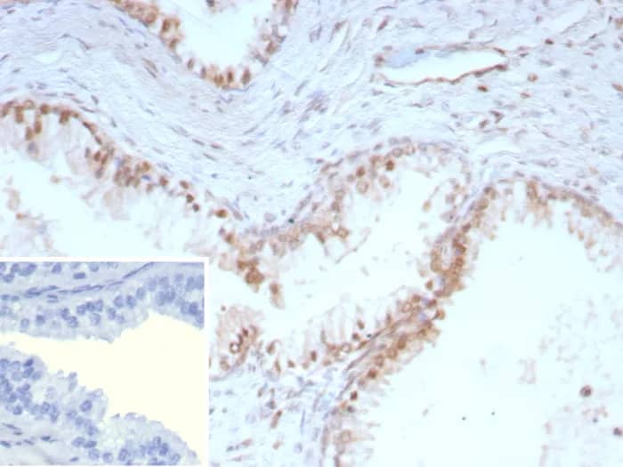Immunohistochemistry-Paraffin: p27/Kip1 Antibody (KIP1/9168R) - Azide and BSA Free [NBP3-24282] - IHC analysis of formalin-fixed, paraffin-embedded human prostate. Strong nuclear staining using p27/Kip1 Antibody (KIP1/9168R) at 2ug/ml in PBS for 30min RT. HIER: Tris/EDTA, pH9.0, 45min. 2°C: HRP-polymer, 30min. DAB, 5min.