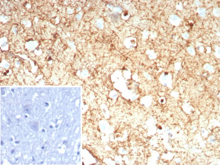 Formalin-fixed, paraffin-embedded human brain stained with Glutamine Synthetase antibody (rGLUL/8621) - Azide and BSA Free. Inset: PBS instead of primary antibody; secondary only negative control.