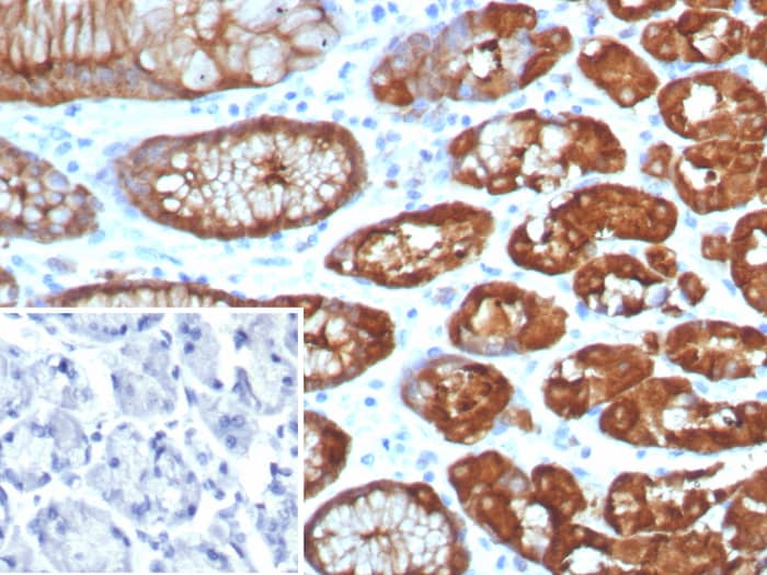 Formalin-fixed, paraffin-embedded human brain stained with Glutamine Synthetase antibody (GLUL/8256R) - Azide and BSA Free. Inset: PBS instead of primary antibody; secondary only negative control.