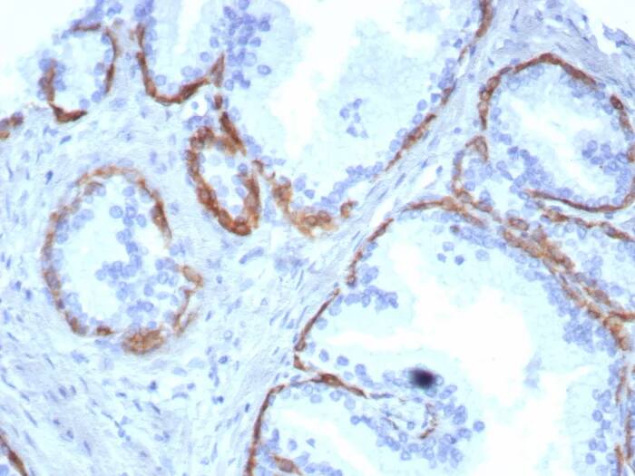 Immunohistochemistry-Paraffin: Cytokeratin 14 Antibody (KRT14/8261R) - Azide and BSA Free [NBP3-24292] - Formalin-fixed, paraffin-embedded human prostate stained with Cytokeratin 14 Antibody (KRT14/8261R). HIER: Tris/EDTA, pH9.0, 45min. 2°C: HRP-polymer, 30min. DAB, 5min.