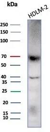 Western Blot: Perforin Antibody (rPRF1/8058) - Azide and BSA Free [NBP3-24297] - Western blot analysis of HDLM-2 cell lysate using Perforin Antibody (rPRF1/8058)