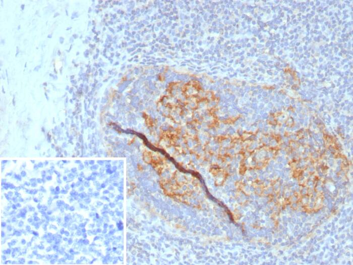 Formalin-fixed, paraffin-embedded human tonsil stained with CD35 antibody (CR1/8284R) - Azide and BSA Free. Inset: PBS instead of primary antibody; secondary only negative control.